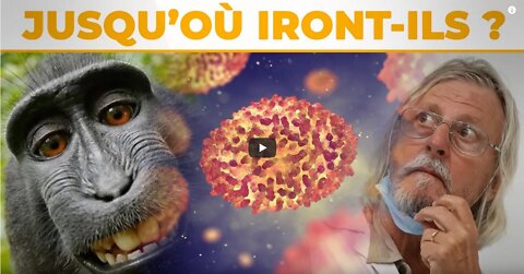 Variole du Singe ils deviennent fous !