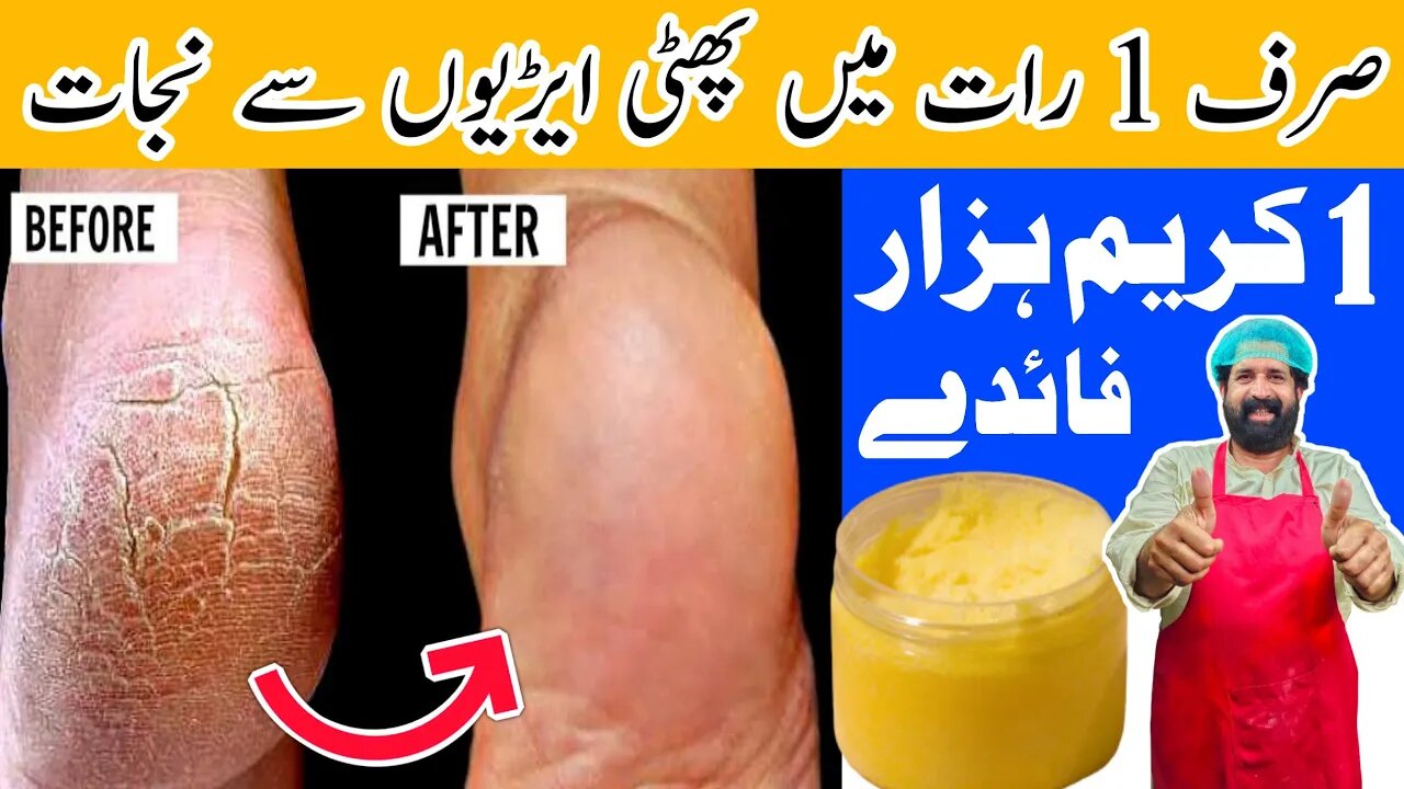 Remove Cracked Heels In Over Night | Get Beautiful Feet Permanently | White & Smooth Feet