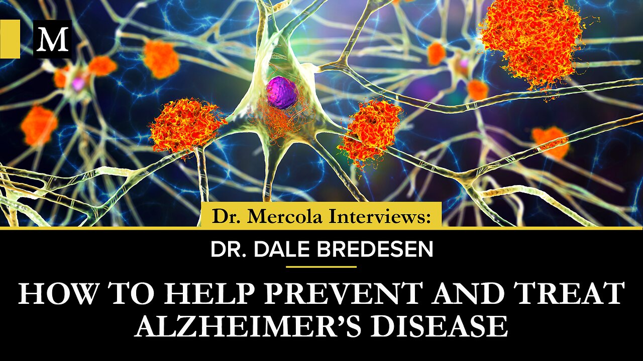 How to Help Prevent and Treat Alzheimer's Disease- Interview with Dr. Dale Bredesen