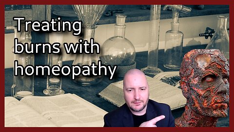 Treating burns with homeopathy