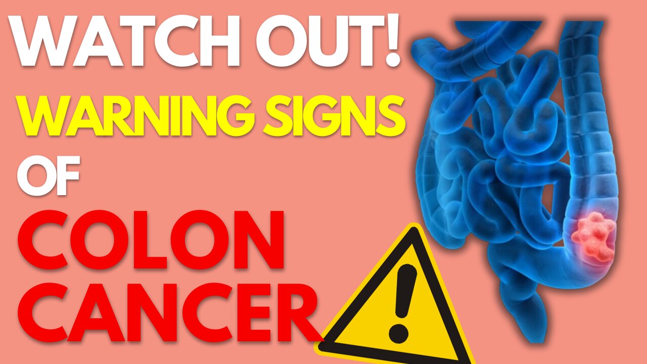 Don't Ignore The Early Stage of Colon Cancer!