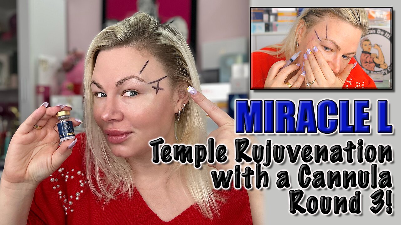 Temple Rejuvination with Miracle L via Cannula! AceCosm, Code Jessica10 saves you money