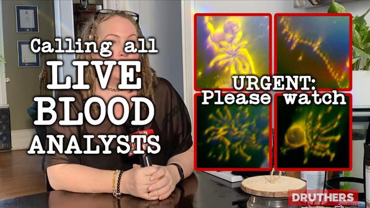 🔥💉 What the Heck is Going On in People's Blood After Vaccination? This is Interesting...