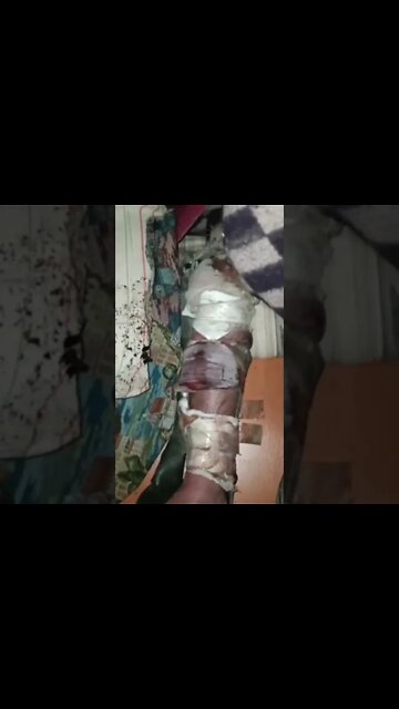 🇺🇦 Azov People Rotting Alive In The Azovstal Catacombs!