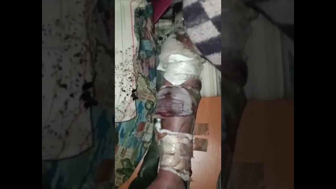 πΊπ¦ Azov People Rotting Alive In The Azovstal Catacombs!