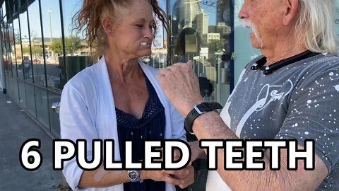 🔥6 PULLED TEETH & EXTREME PAIN..HEALED NO PAIN