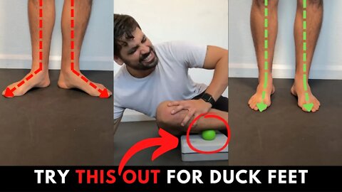 #1 Plan for Fixing your Duck Feet | New Pronation Exercises and Self Massage #posture