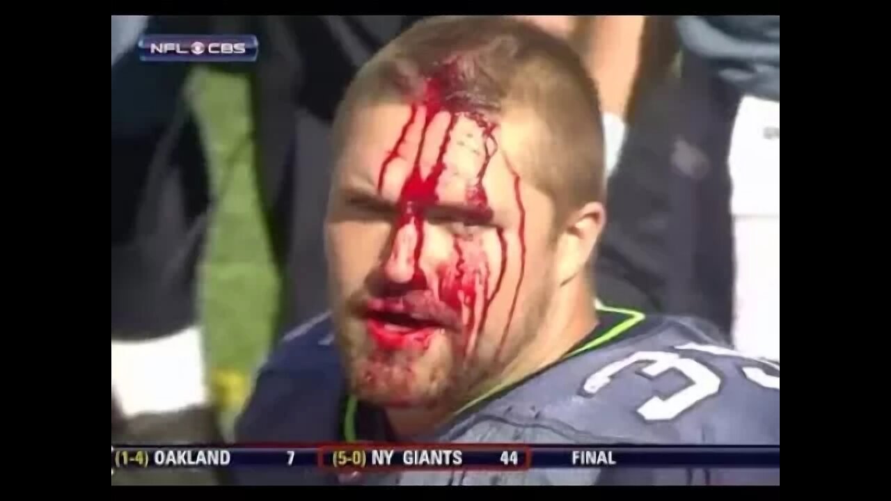 NFL Bloody Moments (HD)