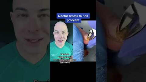 Crazy fingernail problem! | 208SkinDoc