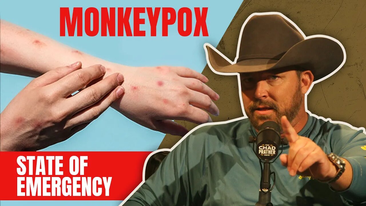 Monkeypox: The Left's Latest Weapon of Control | The Chad Prather Show