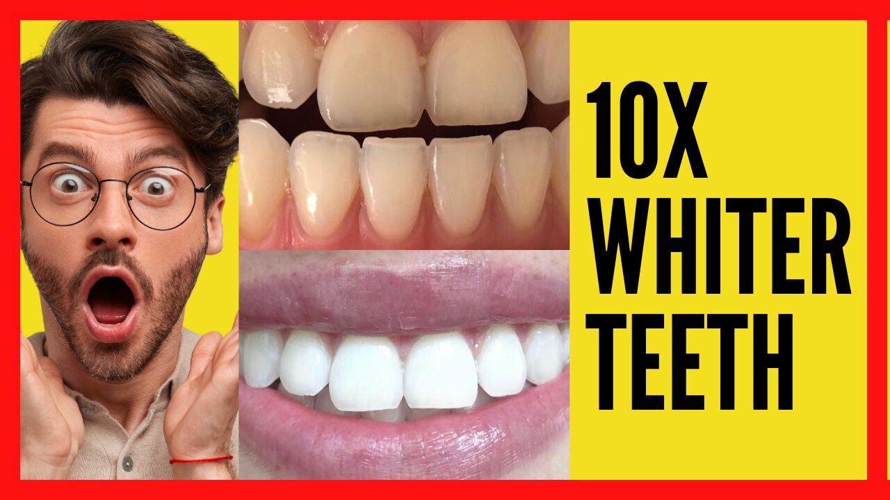 10 x WHITER TEETH