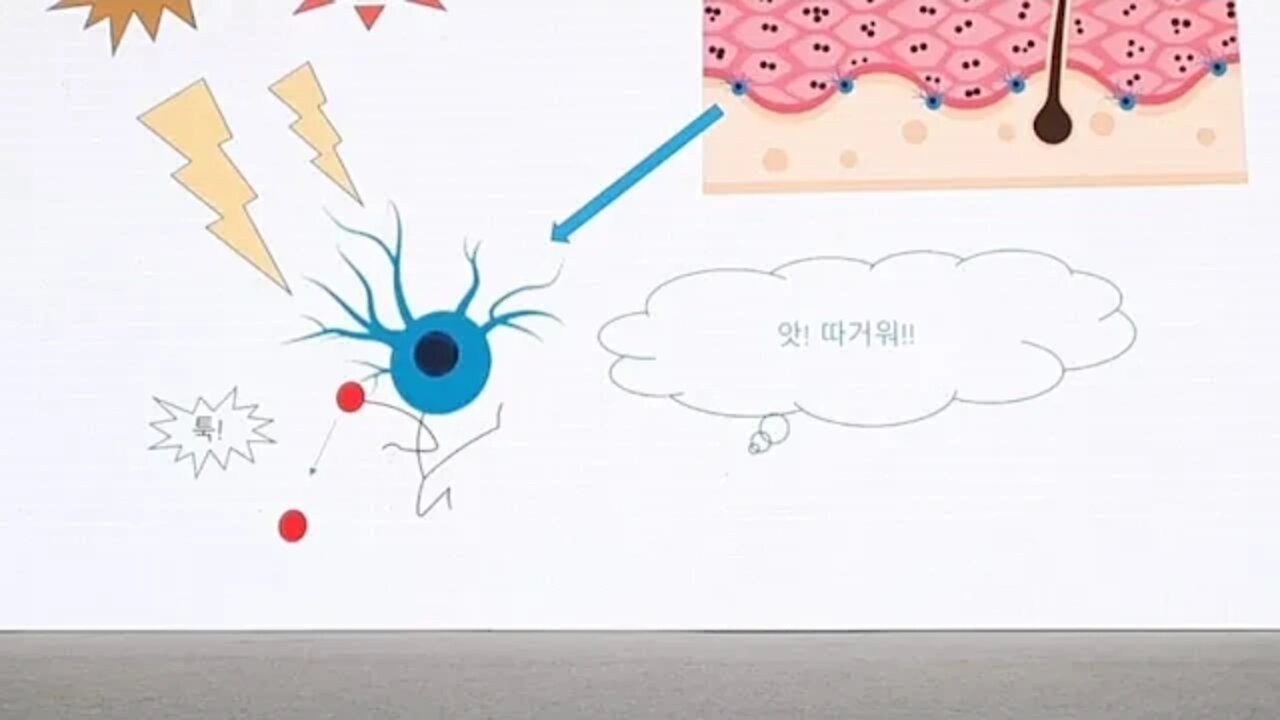 멜라닌 색소 백반증 세텍 학여울