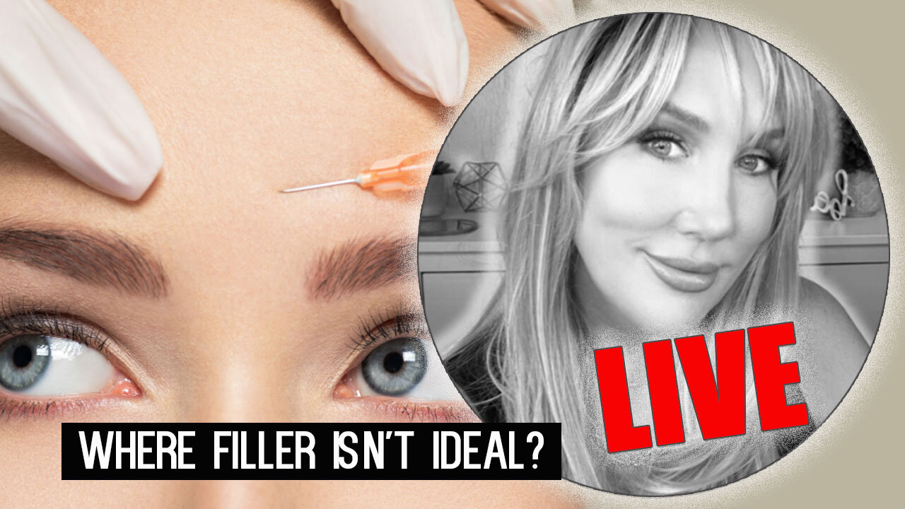 Where dermal filler isn't ideal // Facial Rejuvenation Education & Safety #diyskincare