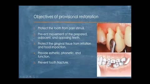 Operative L15 (Fixed Prosthodontics:Provisional Restoration And Bite Registration)