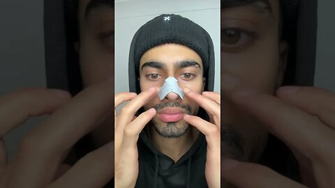 ASMR Blackhead Removal Tutorial