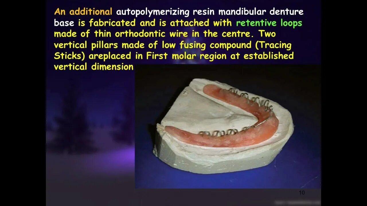 Prosthodontics L7 (Neutral Zone Concept)