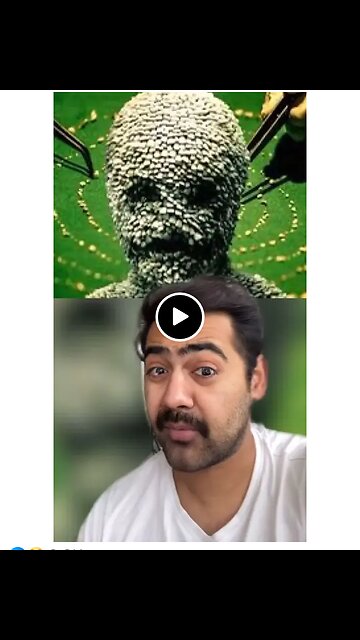 500 TEETH!!! WATCH 🛑