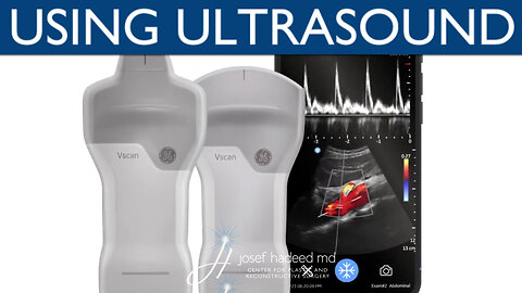 Using Ultrasound Technology in Plastic Surgery