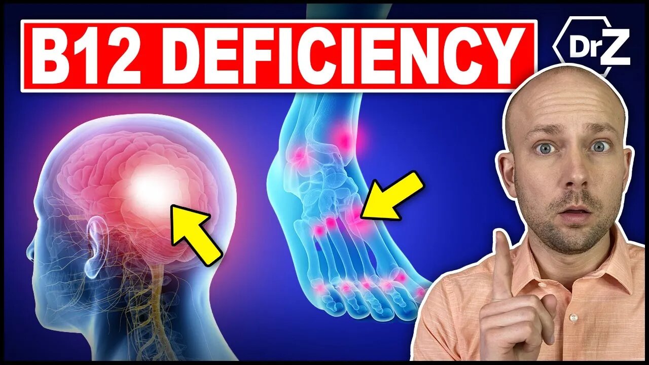 7 Unusual Signs of A B12 Deficiency - Doctor Explains