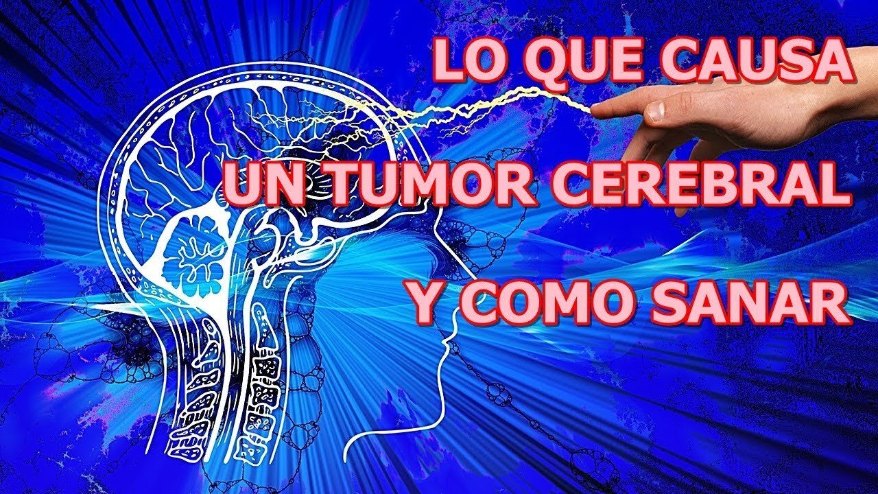 LO QUE CAUSA EL DESARROLLO DE UN TUMOR CEREBRAL Y COMO SANAR