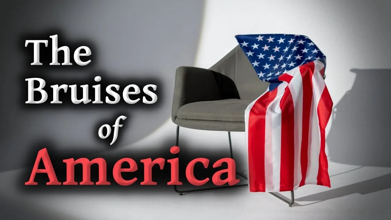 The Bruises Of America - Why So Controversial?