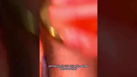 amazing body hair remover