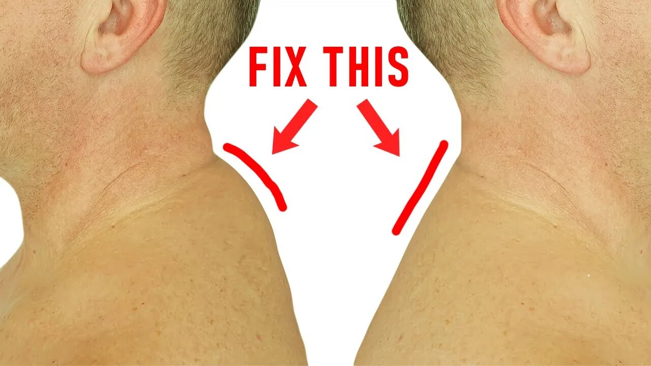 How to Get Rid of a Neck Hump at Home (Easy Method)