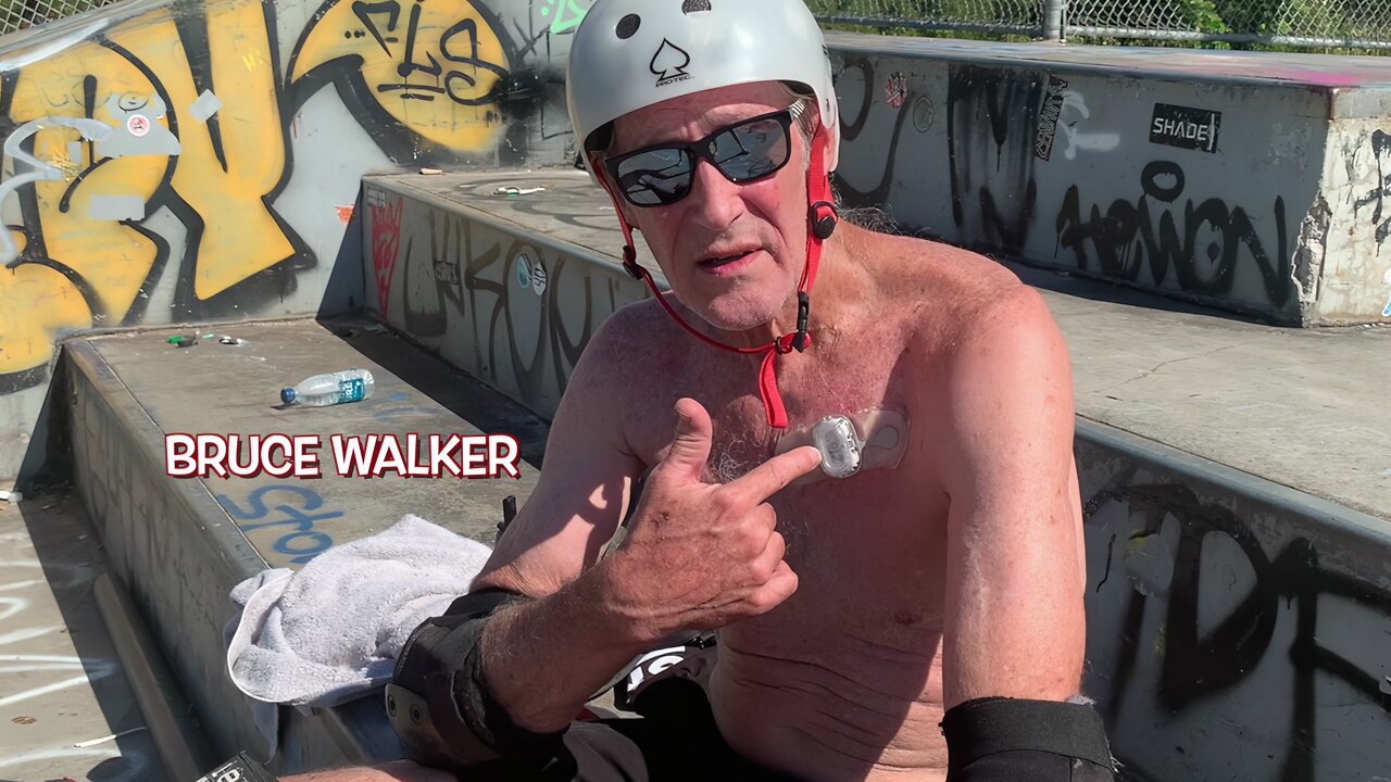 SKATEBOARDER: 70-year-old Advanced Heart Failure Patient