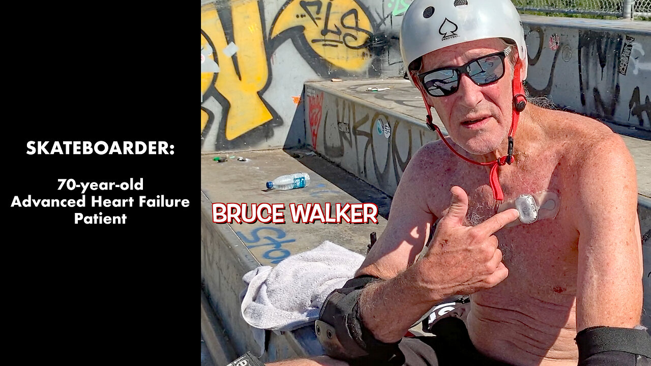 SKATEBOARDER: 70-year-old Advanced Heart Failure Patient