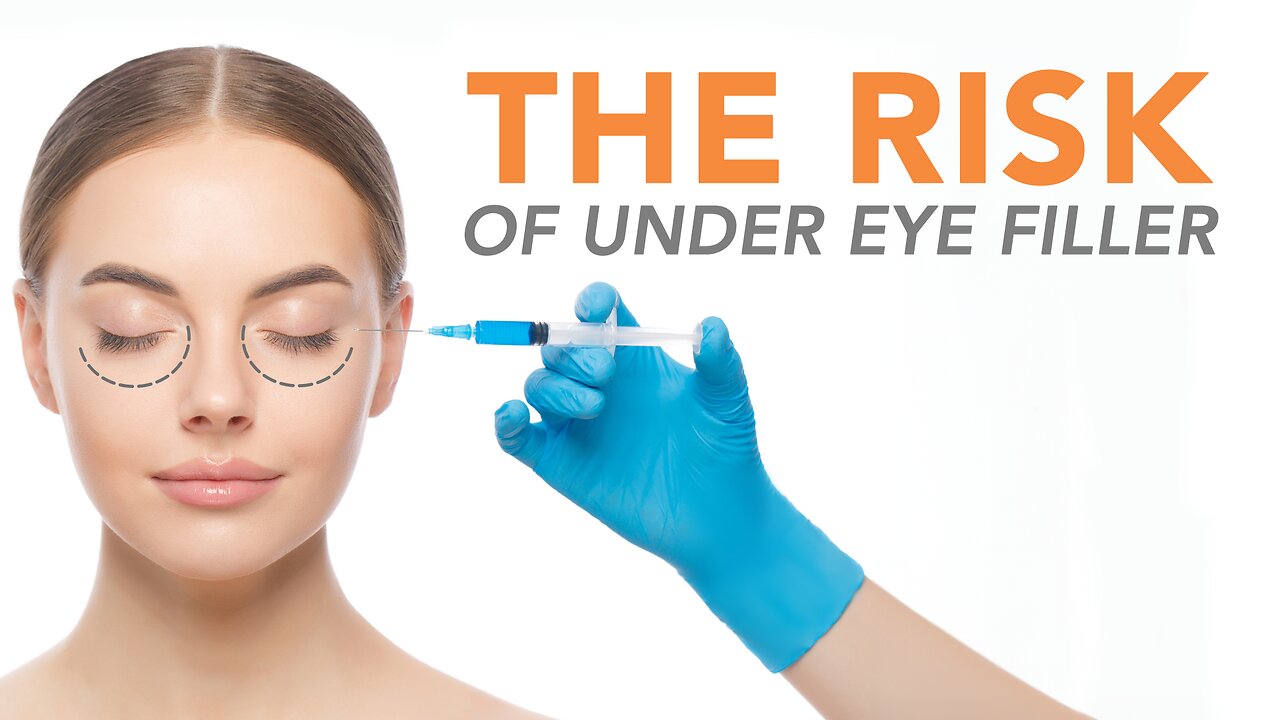 Risks of Under Eye Filler