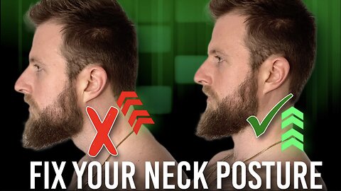 Posture Correction Exercises for Neck | The 5 BEST Things You Can Do!