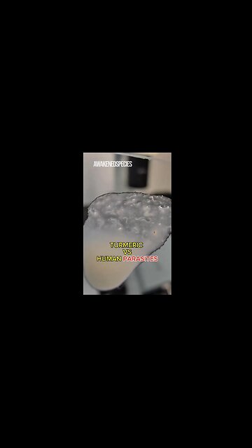 SHOCKING😮Turmeric vs Human Parasites Under the Microscope