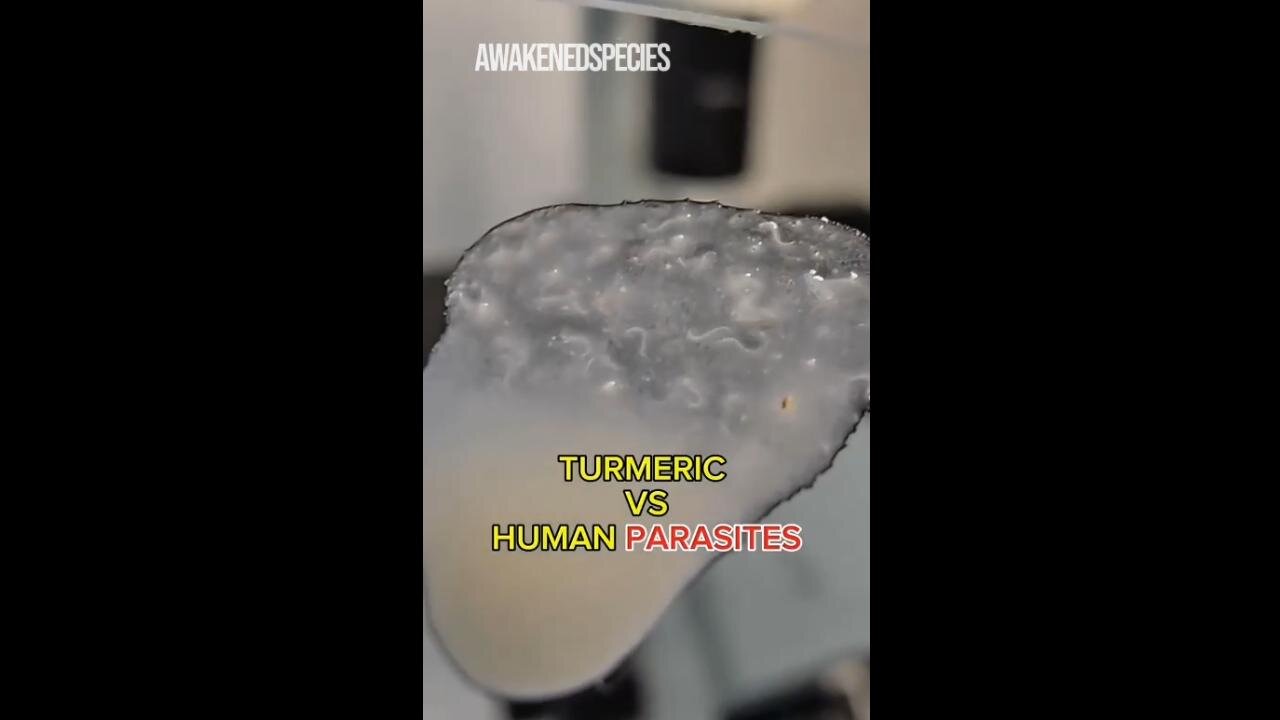 SHOCKING😮Turmeric vs Human Parasites Under the Microscope