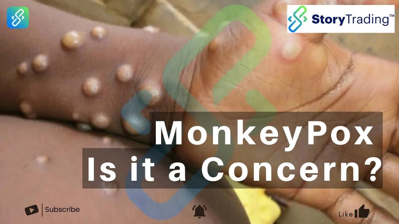 MonkeyPox - Is it a Concern? | StoryTrading