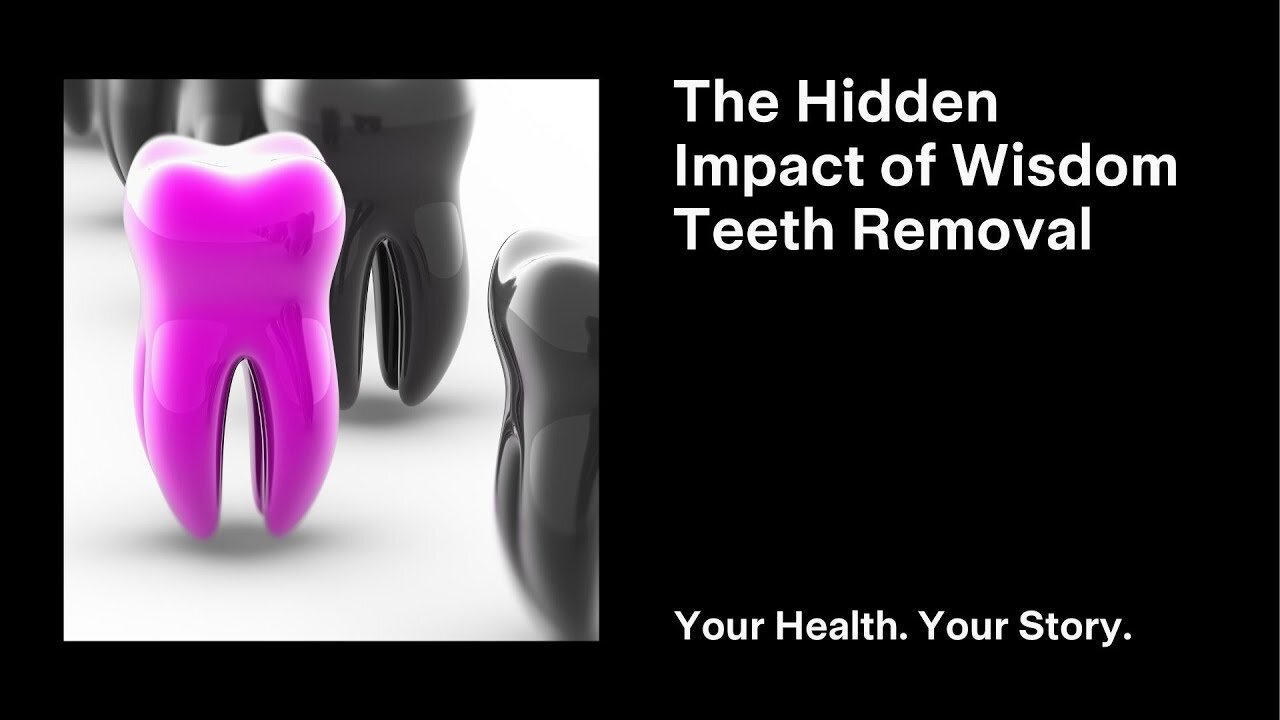 The Hidden Impact of Wisdom Teeth Removal