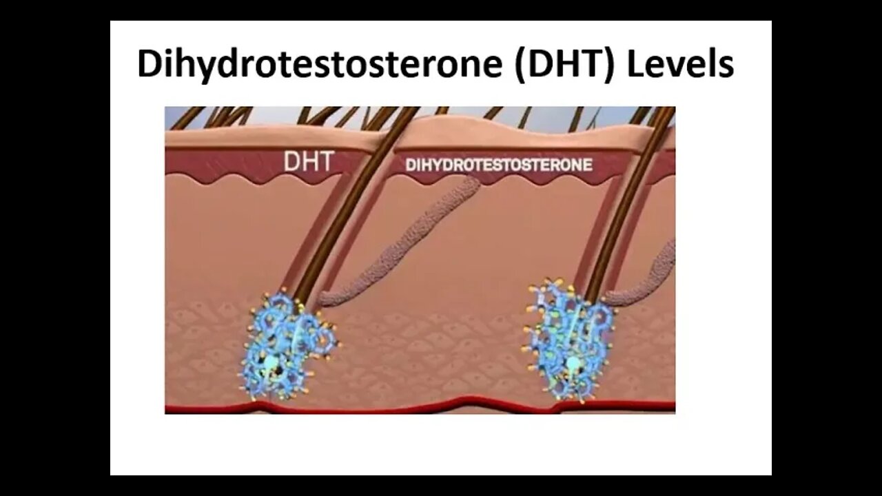 DHT - Dihydrotestosterone - How to naturally balance your hormones