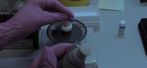 Second case of monkeypox reported in Clark County