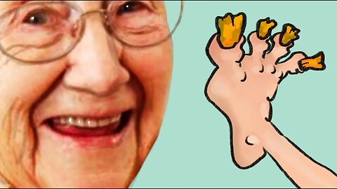 "Would you Rather" suck on an old ladie´s toes or have nail fungus on every toe?
