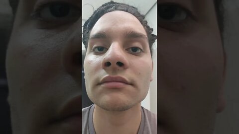 ANTES e DEPOIS de usar MINOXIDIL KIRKLAND por 6 MESES😱