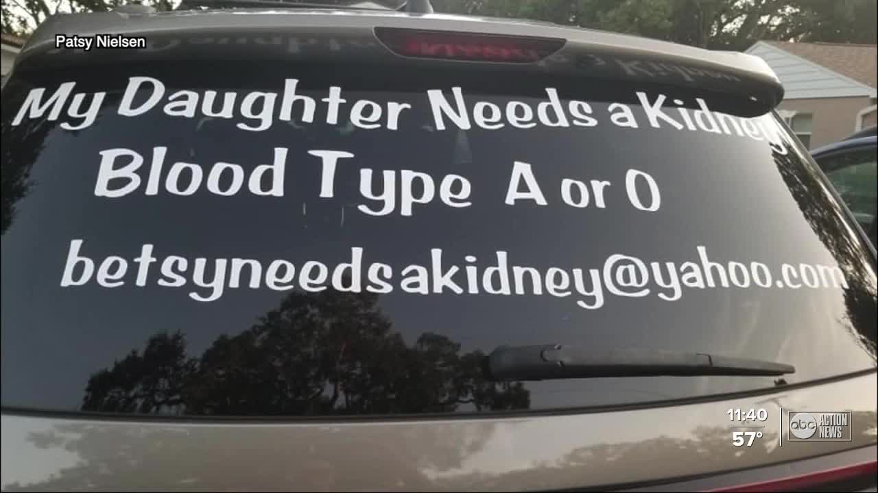 Woman making decals to help others find living donors