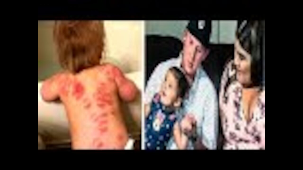 Parents demand answers after 1-yr-old toddler leaves day care covered in bloody marks