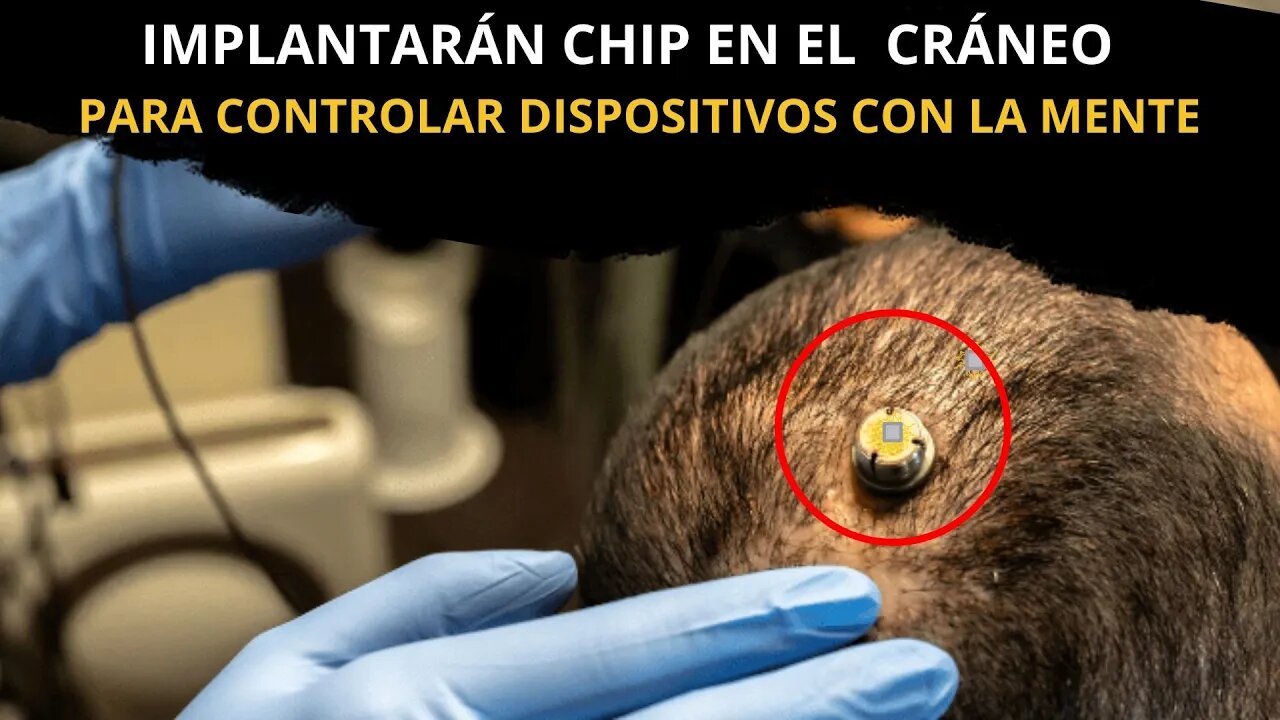 Implantarán de Chip en el cráneo para controlar dispositivos con la Mente