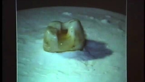 Paul Rubin DDS overviews keys in biological restorative dentistry IAOMT 2007 L.V.