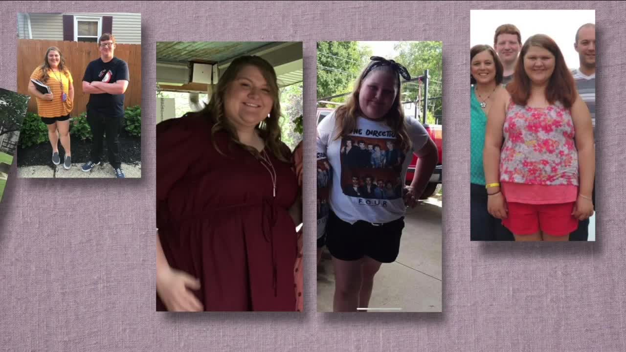 Teens turning to bariatric surgery for weight loss through new Akron Children's Hospital program