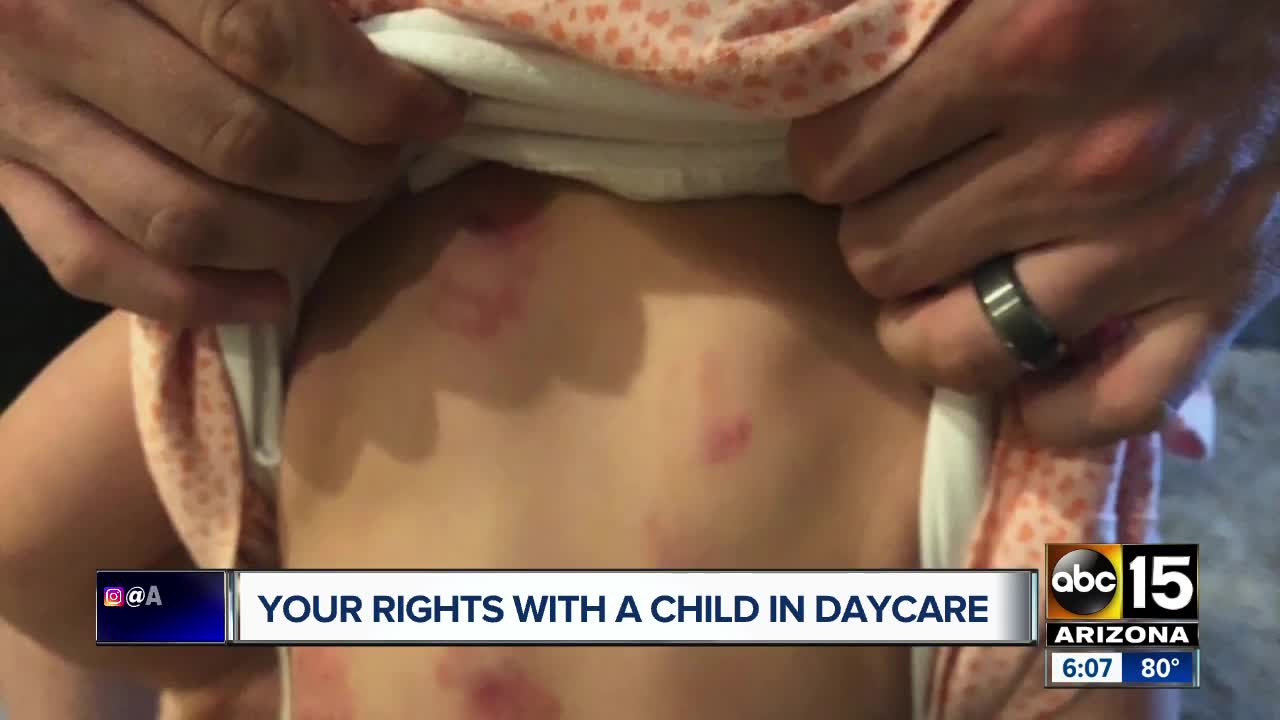What are parents' rights when something happens at daycare?