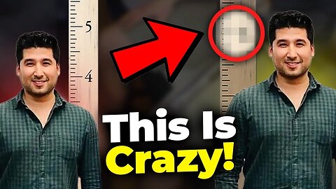 The CRAZIEST Looksmaxxing Procedure (+Interview w/ Guy Who Did It)