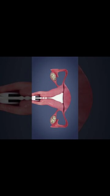 Most Amazing and trending video||relaxing your mind||trendig videos|| #shorts #trending #viral #live