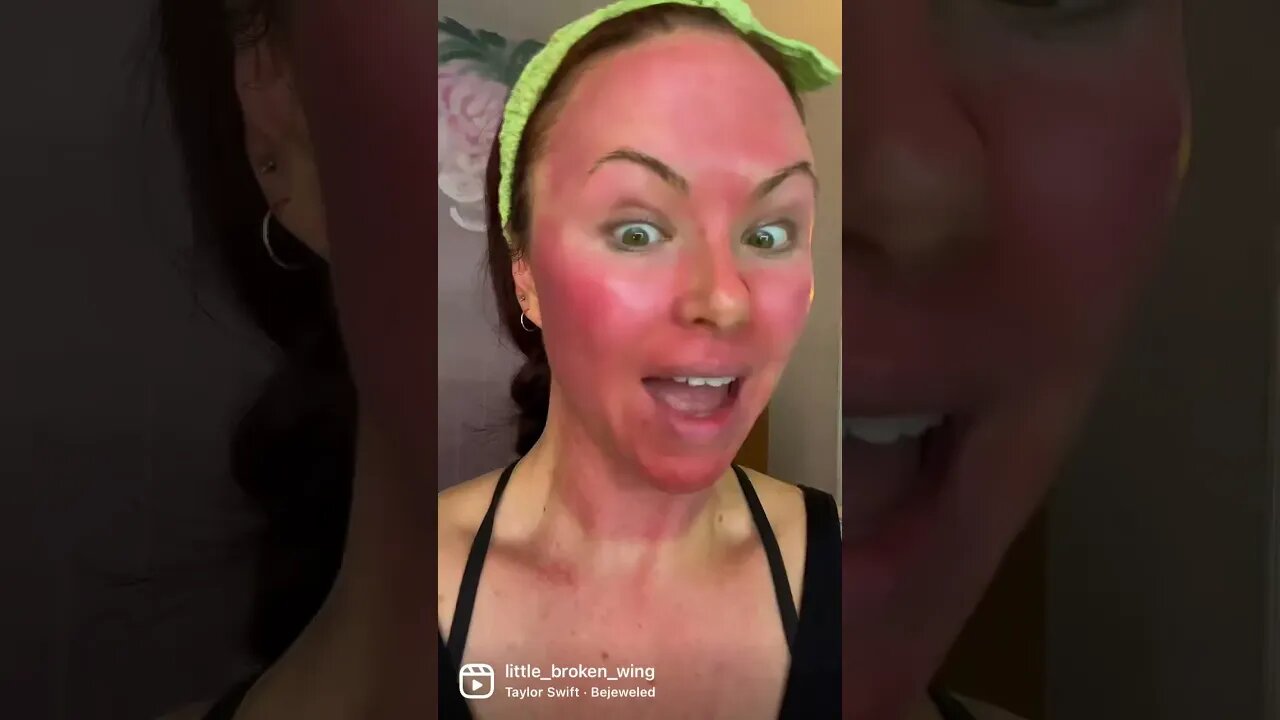 #Microneedling at a shallow of depth overtime, gives amazing results!