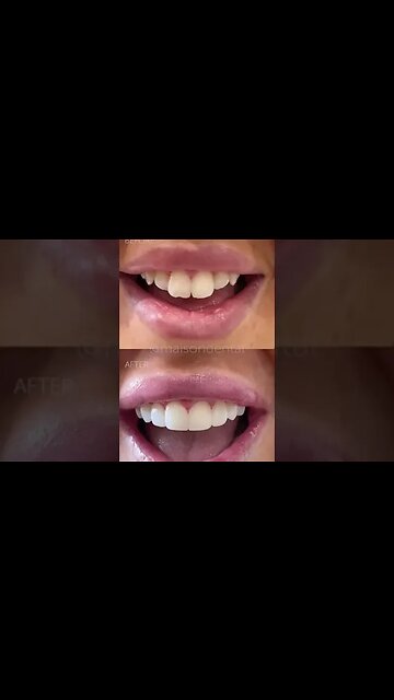 Dental And Teeth Hygiene