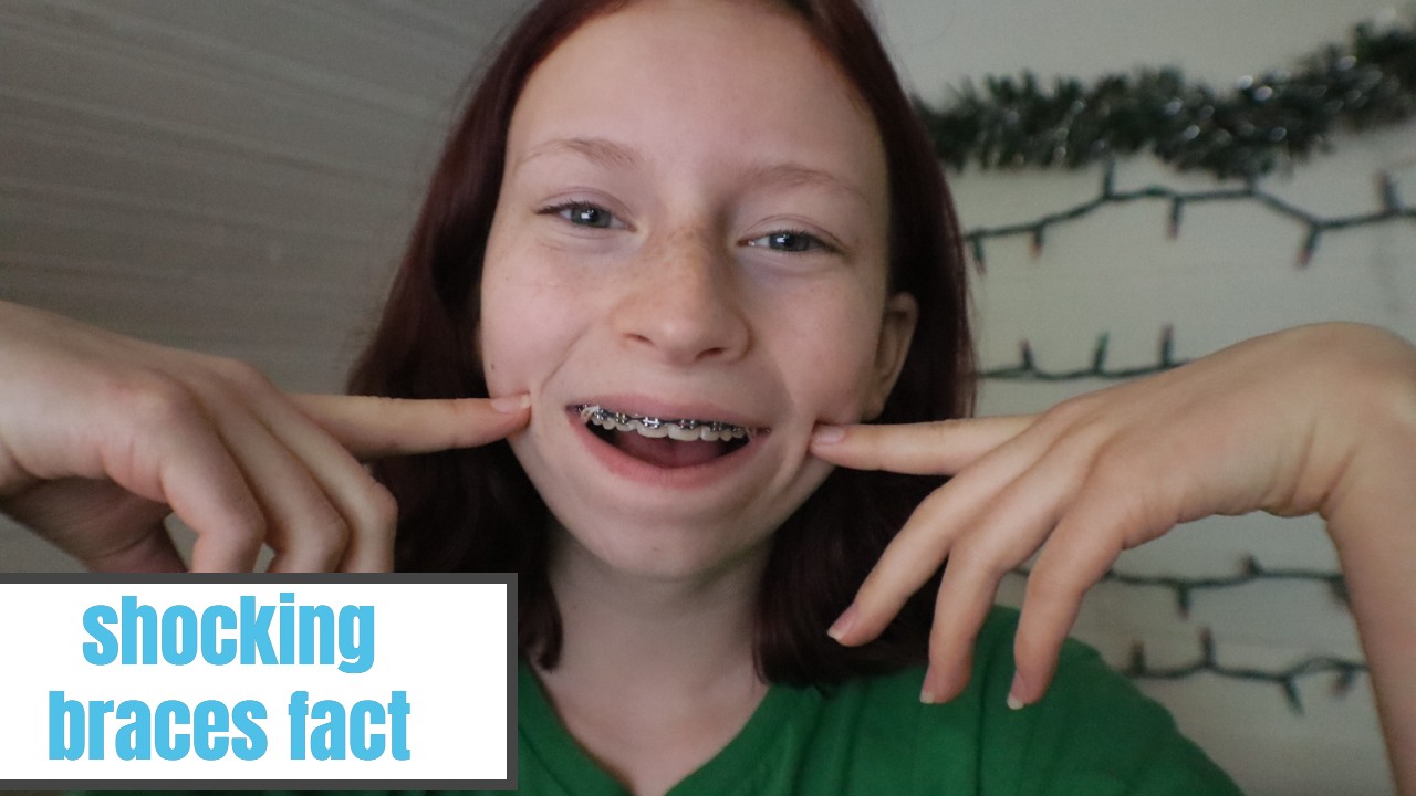 shocking braces fact